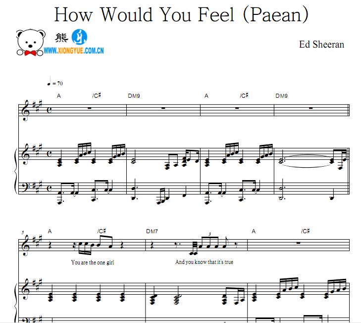 Ed Sheeran - How Would You Feel ٰ