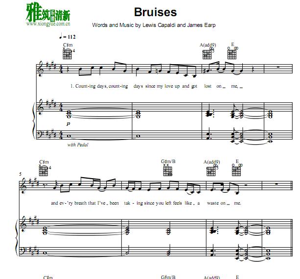 Lewis Capaldi - bruises钢琴伴奏谱